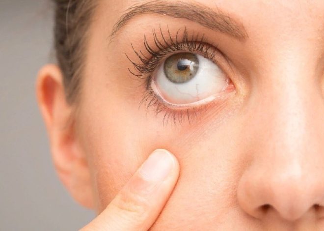 Ячмінь на оці: як швидко зняти запалення і уникнути ускладнень