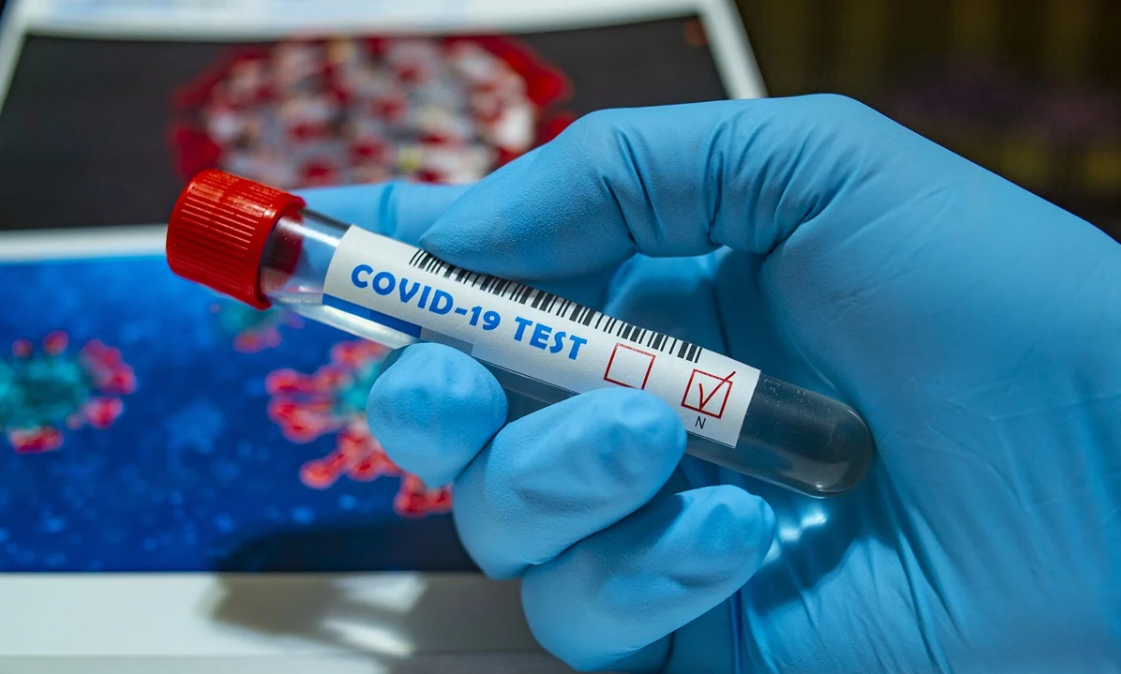 За минулу добу в Україні виявили 3409 нових випадків COVID-19.
