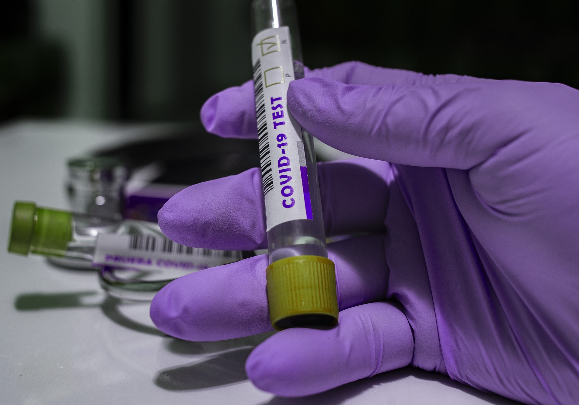 COVID-19 і вакцинація: у МОЗ уже склали графіки та “розподілили всіх людей за пріоритетністю”